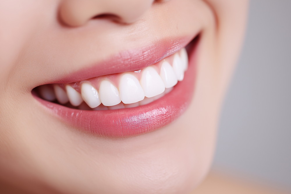 ホワイトニング